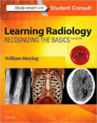 Learning radiology recognizing the basics