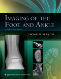 IMAGING OF THE FOOT AND ANKLE