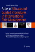 Atlas of ultrasound-guided procedures in interventional pain management