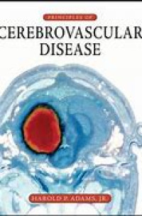 Principles of Cerebrovascular Disease